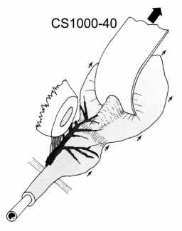 Yu-Holtgrewe Malleable Retractor Blades